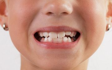 Стоматолог из Узбекистана рассказал, зачем нужно ставить зубные имплантаты