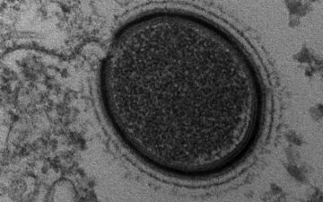 Во льдах обнаружили новые вирусы и бактерии — неужели новая опасность?