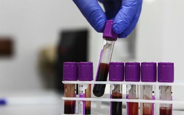 Ученые назвали симптомы скрытого рака