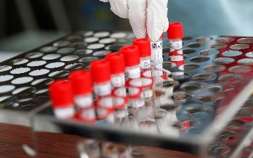 Создан точный и универсальный тест на все виды Covid-19