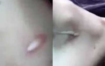 В Андижане мачеха оставила на падчерице шрамы от ножа — видео