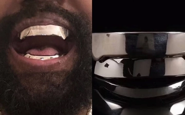 Канье Уэст прикрепил к своим зубам титановые импланты