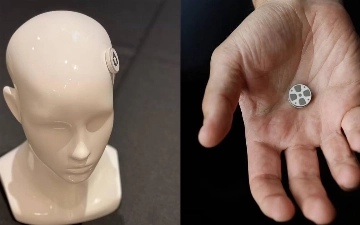 В США тестируется первый мозговой имплант для лечения депрессии