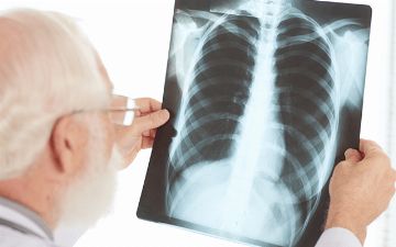 В Узбекистане снова были выявлены новые случаи заражения пневмонией — статистика