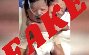 В Минздраве опровергли сообщения о рождении сиамских близнецов в Узбекистане