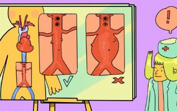 Чаще всего люди умирают, не подозревая о болезни: что такое аневризма аорты