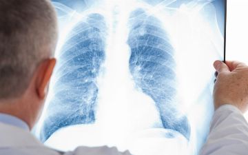 За прошедшие сутки у более 200 человек в Узбекистане была выявлена пневмония