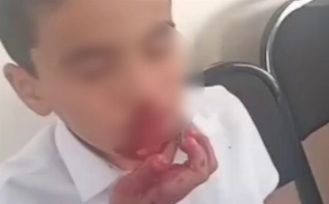 В Кашкадарье учитель разбила нос школьнику 