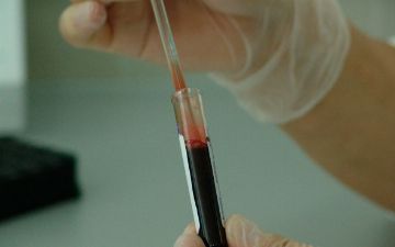 Дерматолог назвала встречающийся у мужчин признак рака