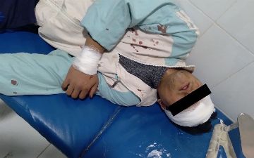 Недовольный ремонтом дороги самаркандец напал на соседа с серпом