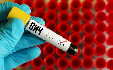 В США испытывают препарат для лечения ВИЧ-инфекции