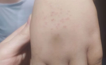 В Ташкенте учительница «воспитывала» первоклассников, обкалывая иглами и саморезами