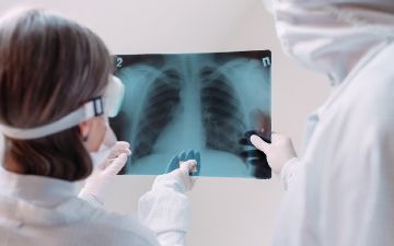 В Узбекистан вернулась пневмония: выявили новых инфицированных — статистика