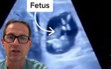 Врач обнаружил у беременной пациентки ребенка в печени 