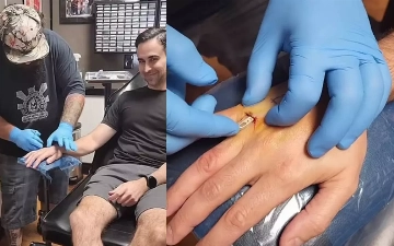 Мужчина вшил себе в руку чип, чтобы не потерять ключи от машины