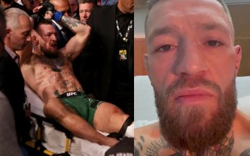 Макгрегор удачно был прооперирован 