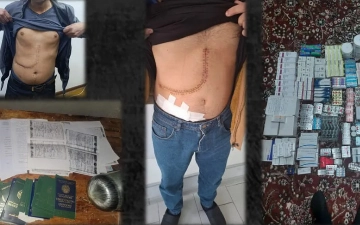 В Узбекистане раскрыли преступную группу, торговавшую человеческими органами и тканями