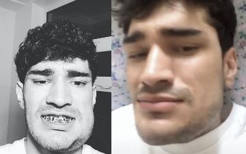 «Решил добить меня до конца»: В соцсетях набирает популярность обращение от жестоко избитого соседом узбекистанца – Repost выяснил подробности