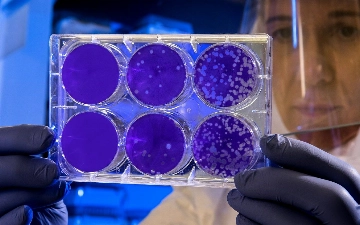 Итальянец заразился одновременно коронавирусом, ВИЧ и оспой обезьян