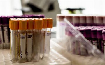 Женщина излечилась от ВИЧ благодаря «мутантной» крови младенца