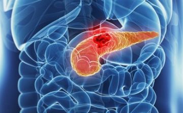 Раскрыт новый метод лечения поджелудочной железы у больных раком