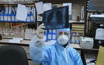 Переболевшие коронавирусом люди рассказали о сохранившихся у них симптомах