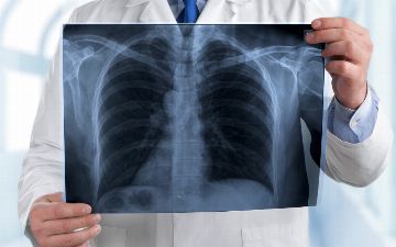 За вчерашний день выявили 10 случаев заражения пневмонией — статистика