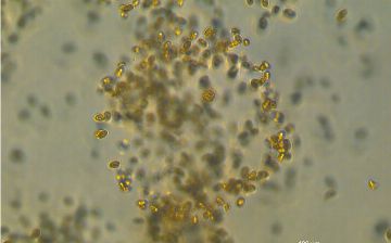 Ученые нашли микроб, который может спасти планету от глобального потепления