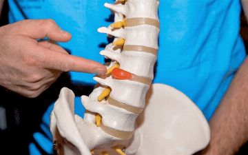 Что можно и что нельзя делать при межпозвоночной грыже? Рассказывает эксперт из Узбекистана