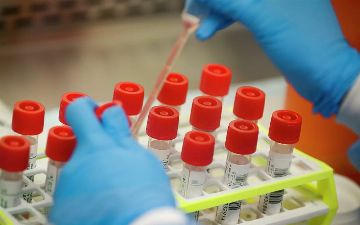 Американские ученые обнаружили биомаркер, способный предсказать тяжесть течения COVID-19