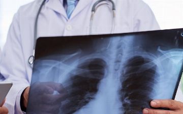 В Узбекистане вновь стали выявлять случаи пневмонии — статистика