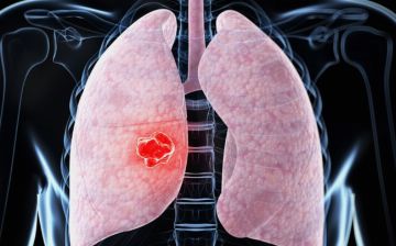 В Узбекистане практически не были выявлены случаи заражения пневмонией за прошедшие сутки — статистика