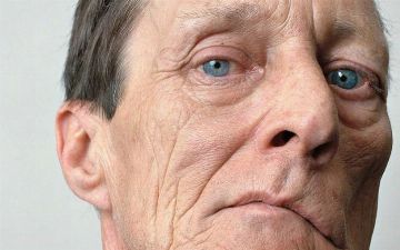  Как снизить риск инсульта?