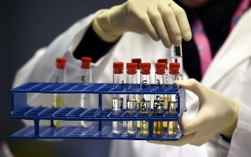 Двух узбекских спортсменов отстранили от соревнований из-за допинга 