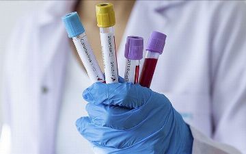 Медик рассказал, когда число заболевших коронавирусом перестанет расти