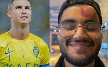 Криштиану Роналду чуть не «вырубил» оператора во время игры