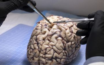 Найден главный фактор долголетия мозга