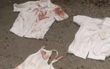 В Ташкенте пьяный мужчина с перерезанными венами угрожал ножом инспекторам ОВД