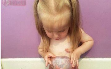 Рассказываем об одном из редких врожденных заболеваниях — гастрошизисе у детей