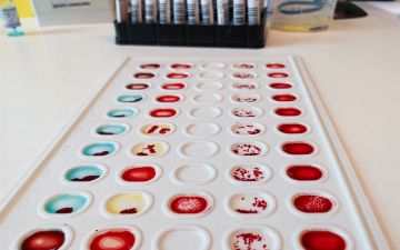 Что такое «жирная» кровь и о чем она может говорить?