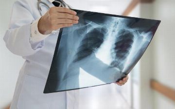 Вчера было выявлено 9 новых случаев заражения пневмонией — статистика