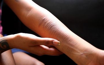 Узбекский психолог рассказала, как помочь детям, которые наносят себе увечия