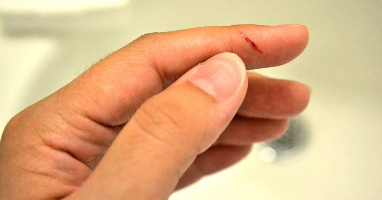 Ученые объяснили особо сильную боль от пореза бумагой 